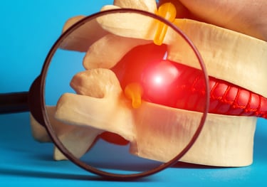 Magnified view of spinal disc herniation with pressure on nerve root.