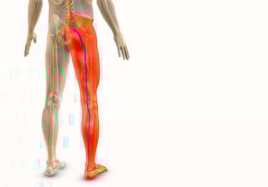 Anatomy of lower body showing sciatic nerve pain running from lower back and glute/pelvis to leg