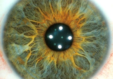 picture of green iris