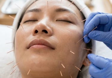 Acupuncture for Cosmetice in Arcadia