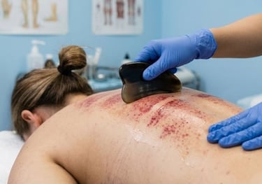 Gua Sha scraping therapy showing prominent red sha petechiae on a prone client's back