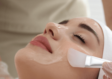 Peeling Químico