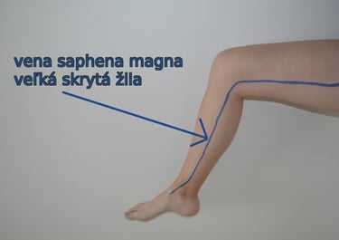 a person with a very long legs and a very long leg