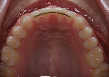 pictures of teeth