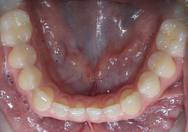 pictures of teeth