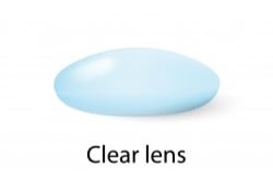 Image of clear lens in normal person with healthy eye vs cataract lens