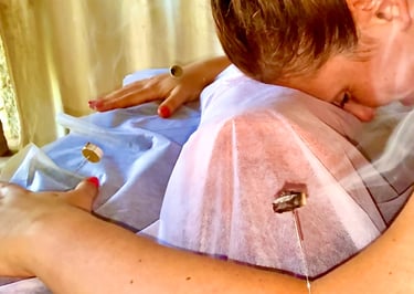 a picture of Alena Booth, founded of Grateful Minds doing acupunture in India