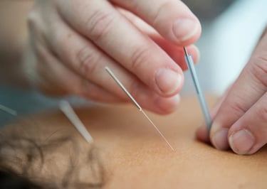 Wednesfield Acupuncture Clinic