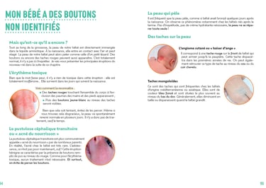 Exemple de chapitre du livre. Reconnaitre les boutons chez mon bébé