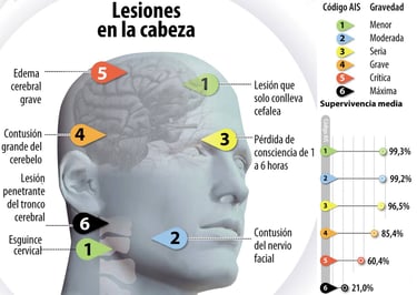 a diagram of a human head with a brain map of the brain