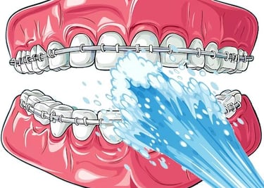 limpiar un aparato ortodóntico con un irrigador dental