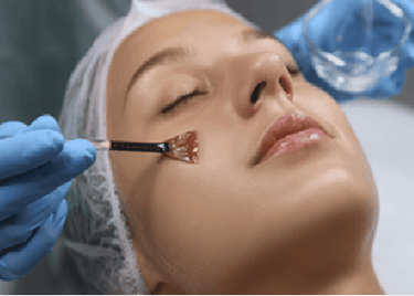peeling facial para manchas
