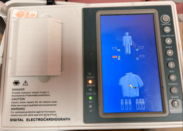A digital electrocardiograph machine displaying lead placement diagrams on a blue medical monitor screen.