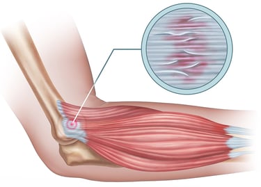 best elbow doctor in bangalore