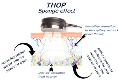 L'effetto Sponge della Sonoforesi