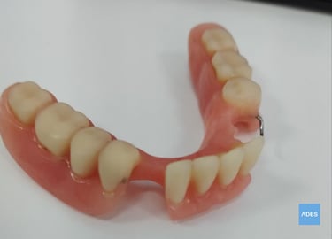 prótesis dental