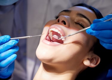 Polished and clean teeth after a professional dental cleaning