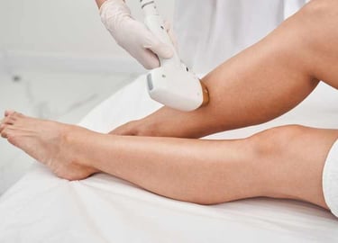 Nova - Permanent Ontharen