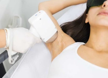 Nova - Permanent Ontharen