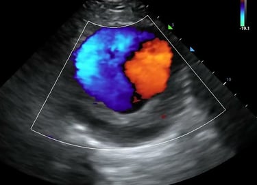 vascular ultrasound imaging perth corewave best vein artery treatment symptom scan doppler bulk bill doctor recommend near me