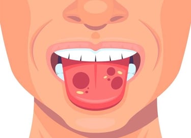 Stomatites hygiene-precision.com