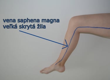 a person with a very long legs and a very long leg