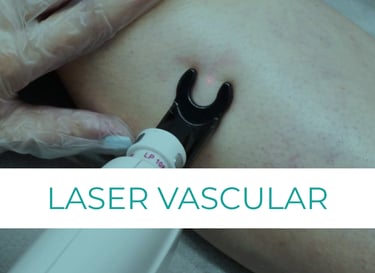 laser vascular arañitas