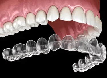 Invisalign Clear Orthodontics Greenville SC