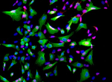 Fluorescently labelled cells from the CTIBIOTECH Biobank. Tissue sourcing.