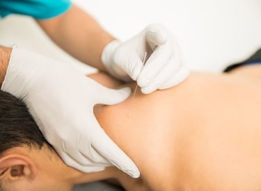 dry needling