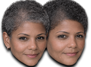 a before/after photo of a woman who has received an SMP treatment on her scalp