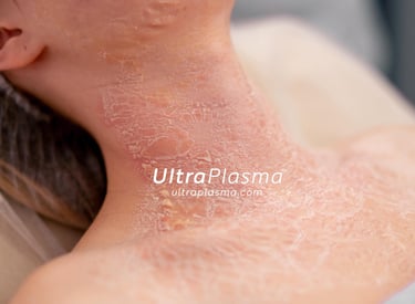 _ultra_plasma_ultra_plazma_ultra-plasma_ultra-plazma