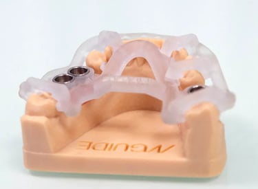 Como es el proceso de la citugía guiada