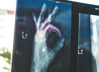 OK hand gesture x-ray