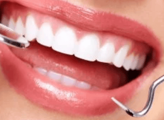 كشف دوري لفحص الفم والأسنان