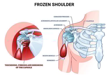 Best Shoulder Pain Treatment In Kochi, Kerala