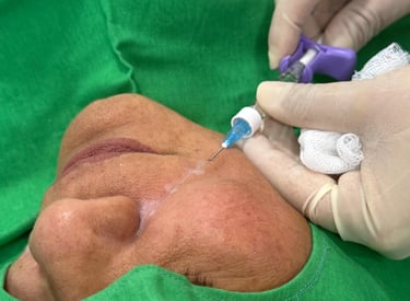 Dra. Lilyan Marissel - Cirugía Plástica y Estética - acido-hialuronico