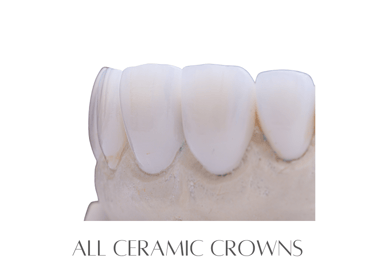 All Ceramic Crowns