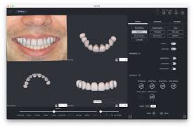 digital smile design done at shree dental care near shyamal satellite