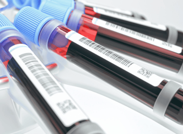 a group of blood test tubes with blood samples