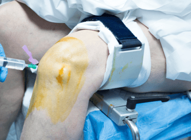 Post-Surgery At Home Recovery