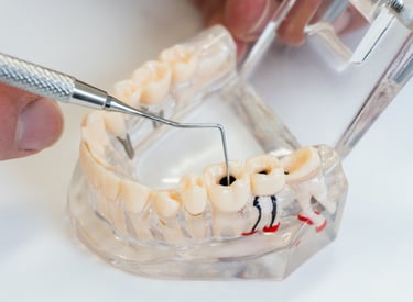 A dental professional uses a metal probe on a transparent anatomical model of human teeth to show cavities.