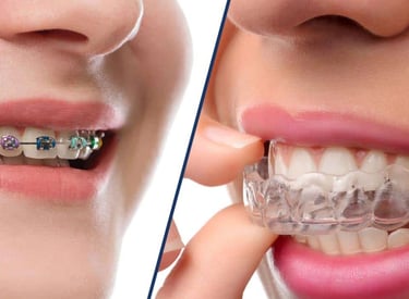 brackets y alineadores dentales