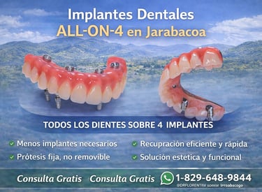 Implantes Dentales All on 4 en Jarabacoa