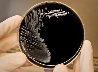 Técnico do Laboratório AMB examinando amostra de água para detecção de Legionella.