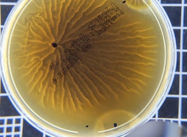 Recipiente de análise laboratorial contendo amostra de água com resultado positivo para Legionella,