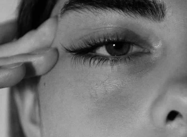 Lower Eyelid Surgery (Lower Blepharoplasty) Explanation Image From Macys Plastic Surgery