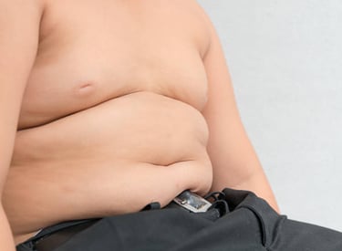 Obesidade