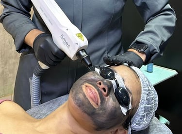 durante o protocolo de tratamento facial conhecido como blackpeel ou peeling hollywood