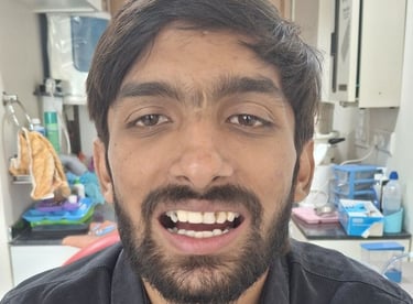 Before image of complete mouth restoration case with multiple dental issues shree dental care